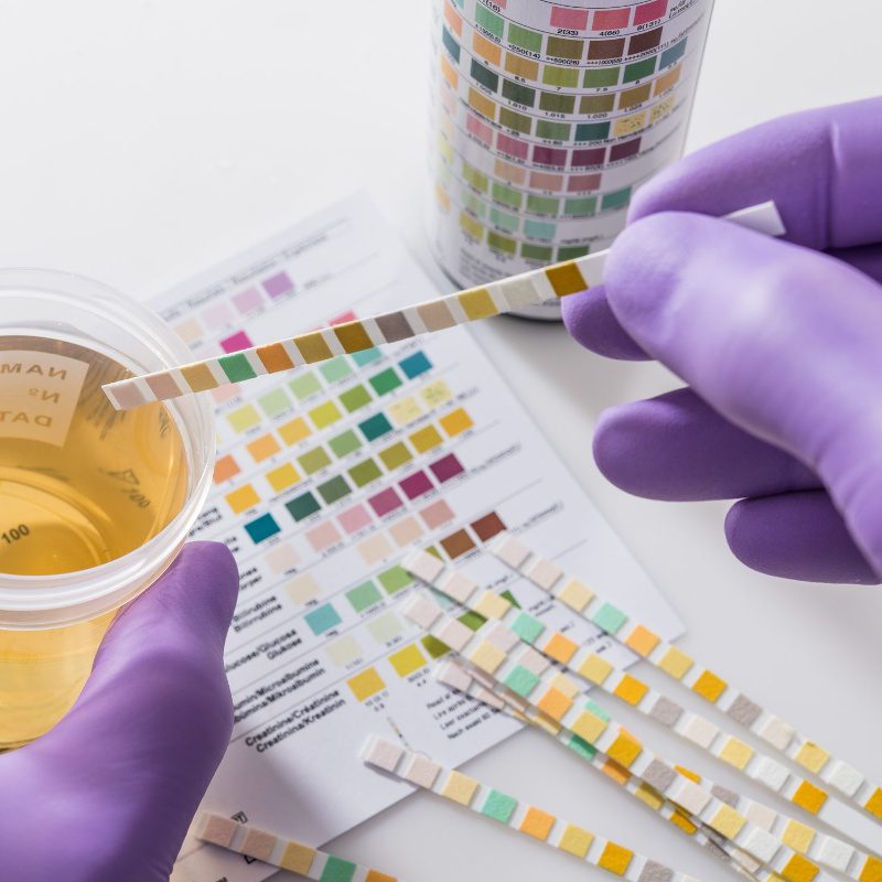 analisi-urine-messina